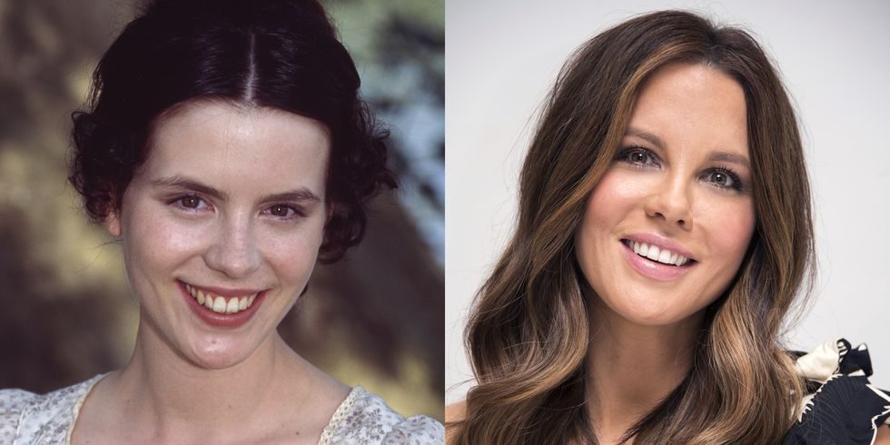 Before and after picture of Kate Beckinsale smiling