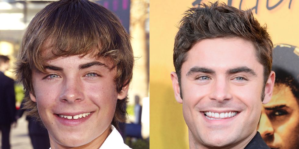 Picture of Zack Efron smiling