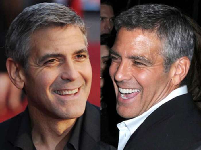 Before and after pictures of George Clooney smiling